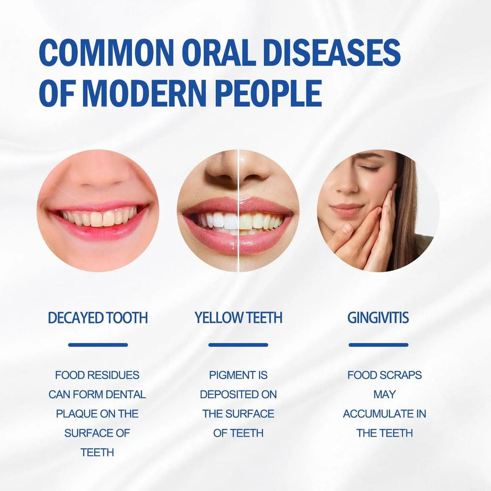 Probiotic Whitening Toothpaste (Pack of 4)